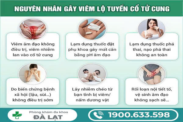 Hình ảnh minh họa